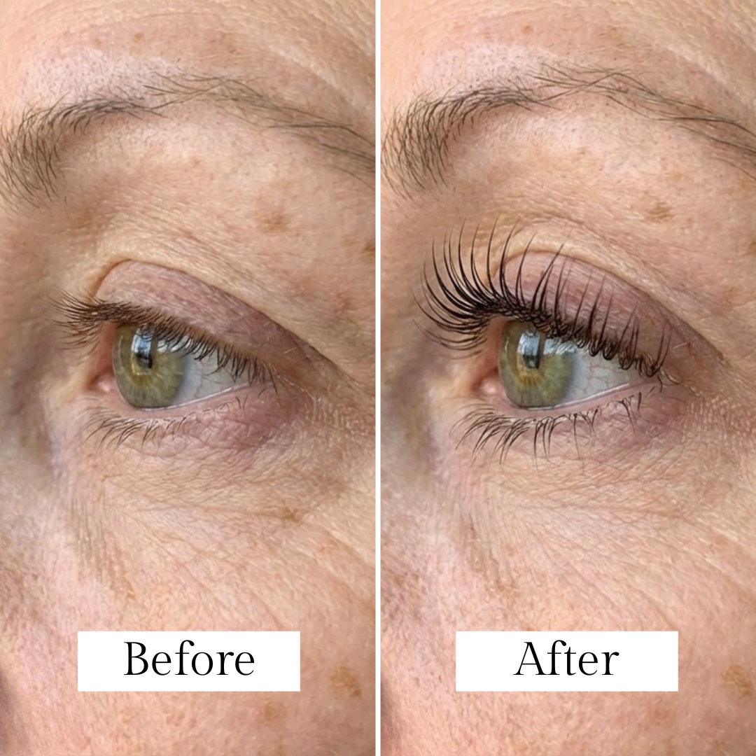 Lunōra Wimpernelixier™